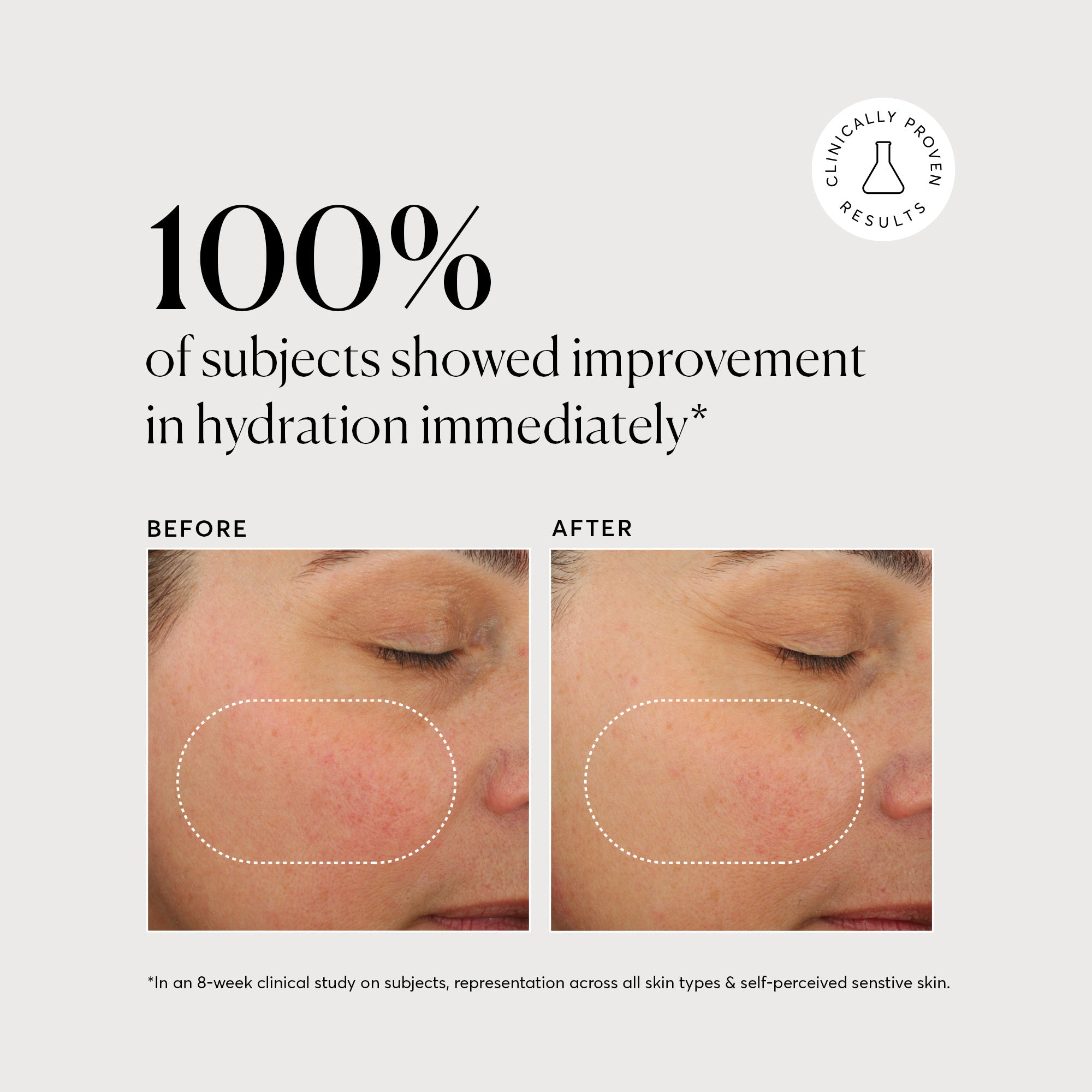 NATR_Plant_Ceramide_Graphics_PackShots_Hydration