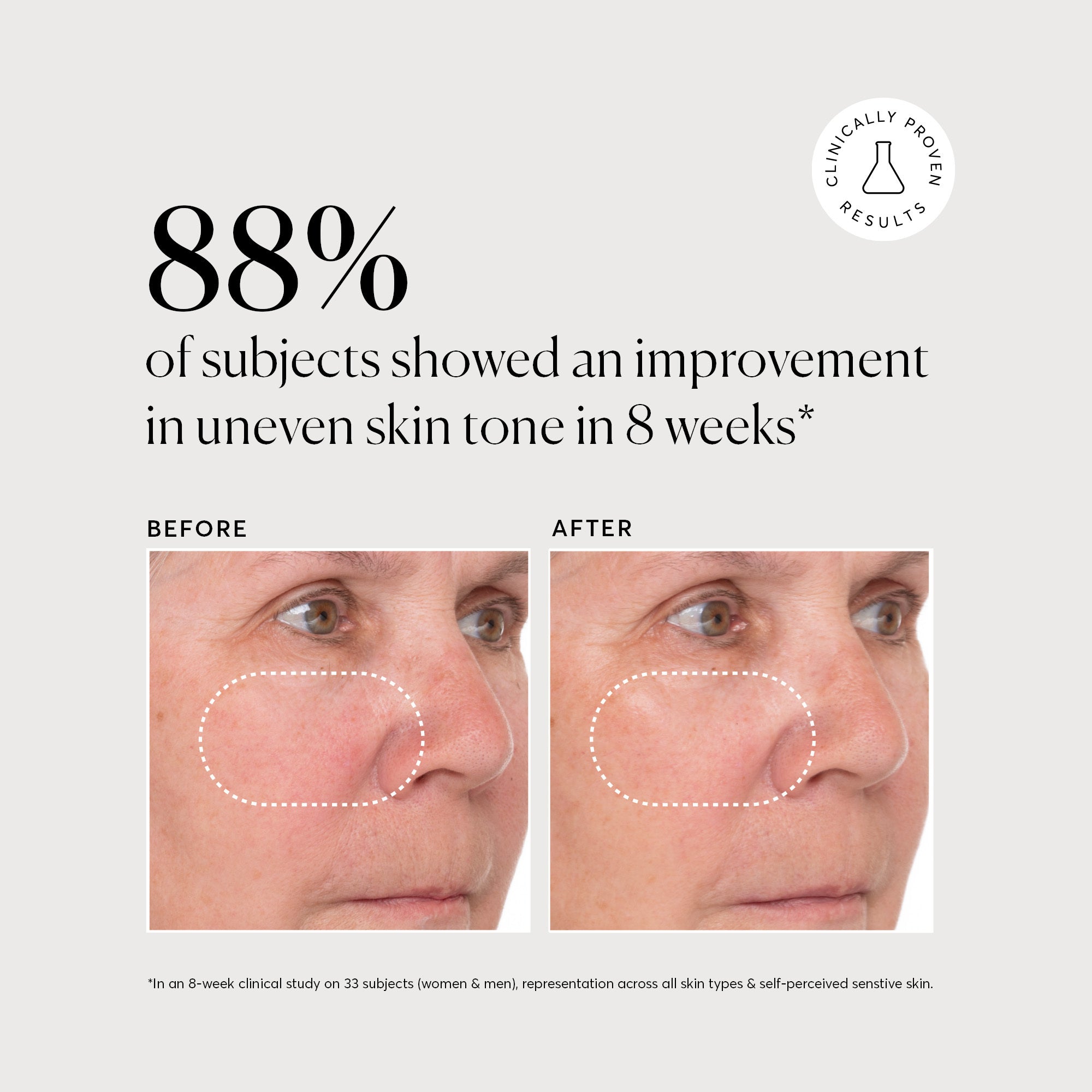 NATR_VitC_Clinical_Graphics_B_A_3_Bone_1