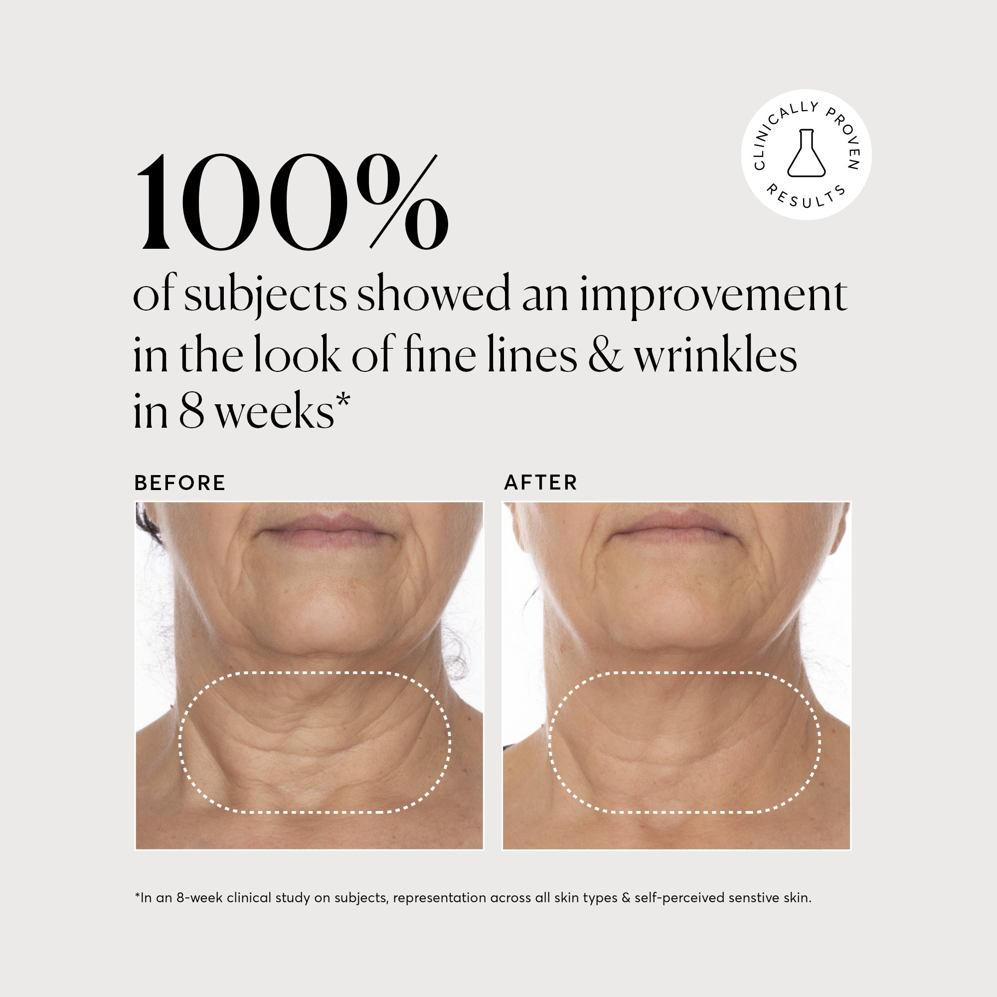 NATR_VitC_Complex_Clinical_Graphics_B_A_FineLines_Bone