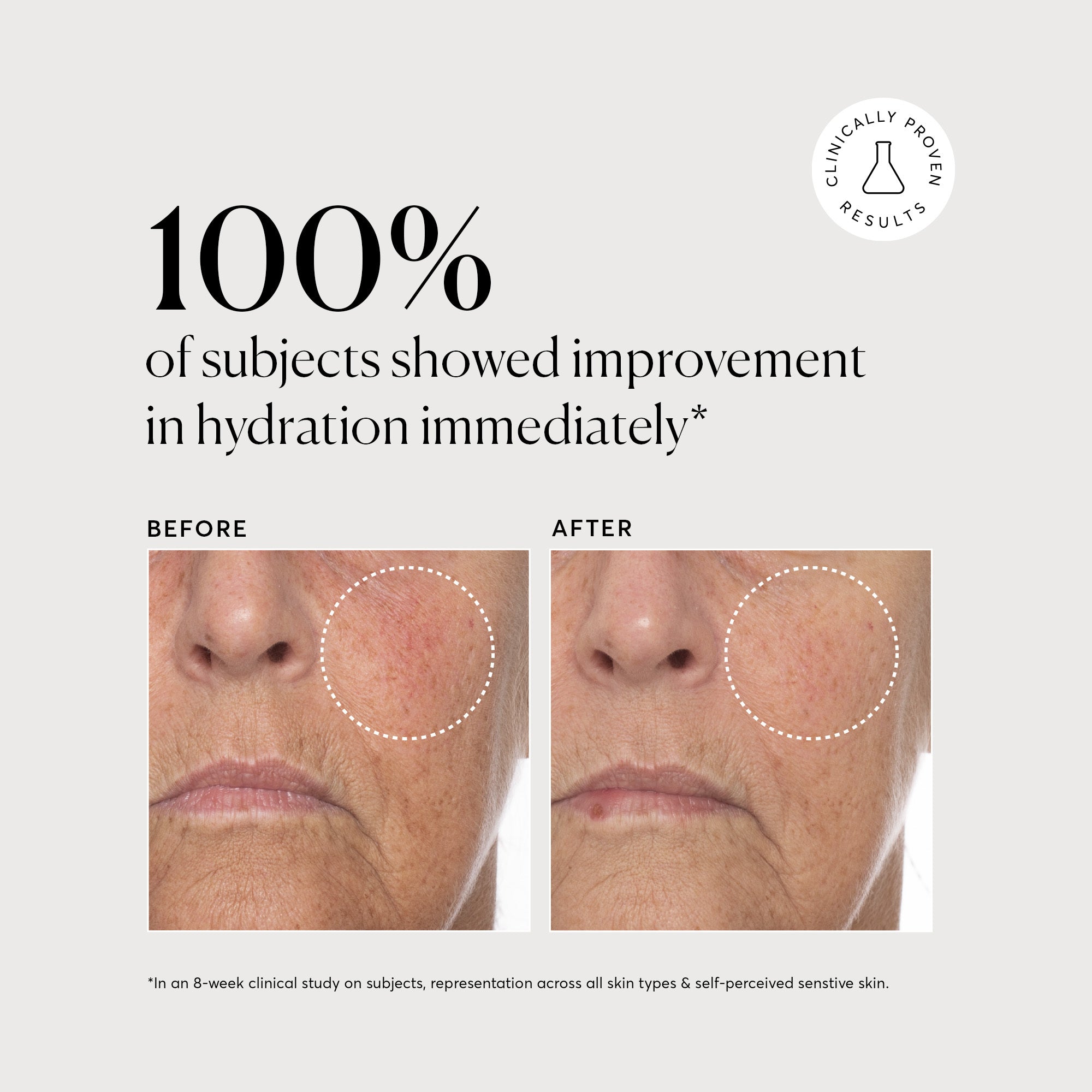 NATR_VitC_Complex_Clinical_Graphics_B_A_Hydration_Bone_8a771691-ae37-4146-9168-e3302c1512d0